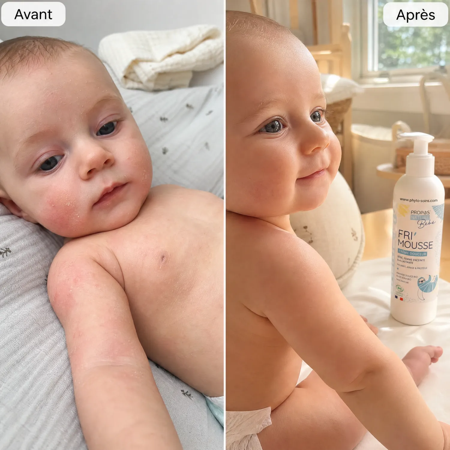 Avant après bébé peau irritée apaisée Fri'Mousse Bio Propos'Nature